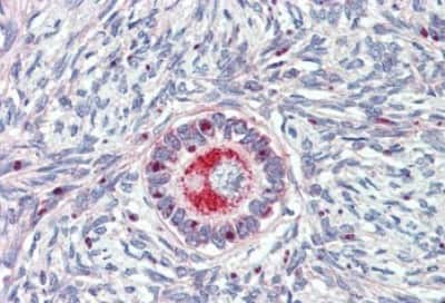 Immunohistochemistry-Paraffin: TM9SF1 Antibody [NBP3-14497]